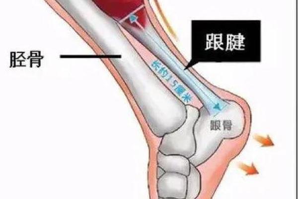 医学专家 哈利伯顿可能是比目鱼肌 跟腱出现问题 步行者队