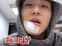 赵睿过年受伤破相晒自拍照 赵睿嘴角的伤是怎么弄的？ 