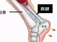 医学专家 哈利伯顿可能是比目鱼肌 跟腱出现问题 步行者队